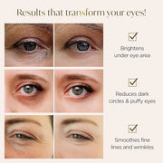 PLANTIFIQUE Gold Under Eye Patches for Puffy Eyes and Dark Circles 20+5 Pairs Under Eye Masks for Dark Circles and Puffine...