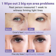 Eye Face Serum, Firming Anti-Wrinkle Serum, Reduces Eye Bags, Dark Circles, with Vitamin E, Helps Anti-Aging Eye Serum, 0....