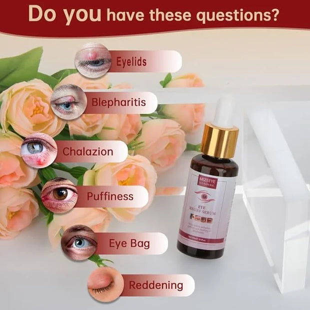Chalazion Eye Treatment For Blepharitis, 2 PCS Moisturize Eyelids Serum and Chalazion Remover, Gentle Under Eye Relief Ser...