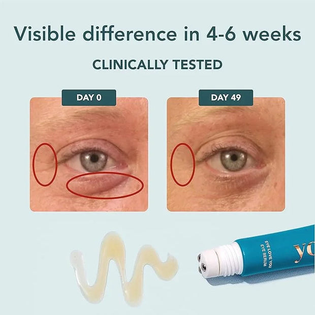 YOURS Eye Serum with Caffeine & Antioxidants | Hydrates and Brightens Under Eye Area | Restores Skin Firmness and Reduces ...