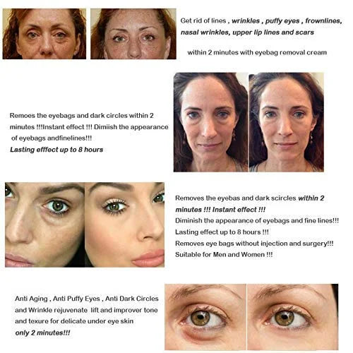 Magic Eye Cream, Instantly Remove Under Eye Bags Wrinkles Puffiness Dark Circles and Fine Lines, Anti Aging Eye Cream for ...