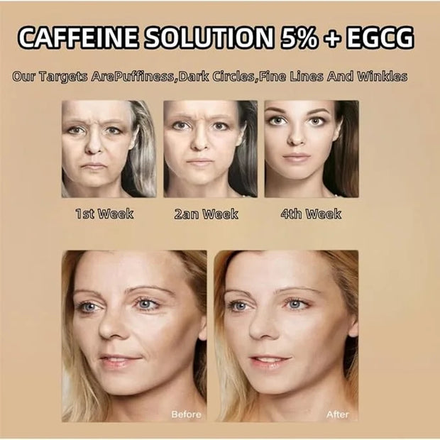 Caffeine Solution 5% + EGCG, Caffeine Eye Serum For Face, Moisturizing Under Eye Solution For Reduces Dark Circles & Puffi...
