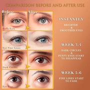 24K GOLD Eye Mask– 60 Pcs - Gold Under Eye Mask Retinol & Collagen - Puffy Eyes and Dark Circles Treatments – Look Younger...