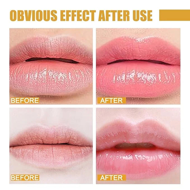 2 Pcs Lip Balm Honey Pot, Lip.