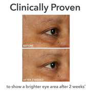 Dr Dennis Gross DermInfusions Fill + Repair Eye Cream: Hydrating & Brightening Treatment for Dark Circles, Fine Lines & Wr...