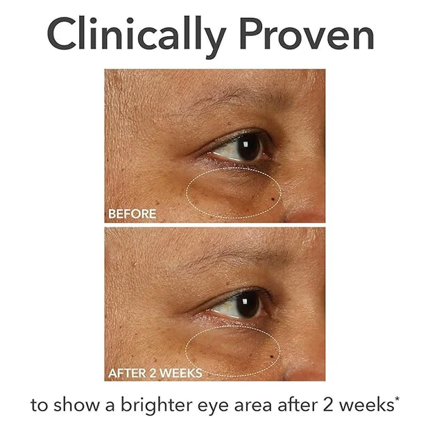 Dr Dennis Gross DermInfusions Fill + Repair Eye Cream: Hydrating & Brightening Treatment for Dark Circles, Fine Lines & Wr...