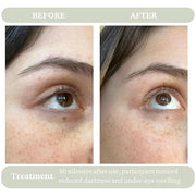 Cucumber Eye Serum - Hydrating Under Eye Serum for Dark Circles & Puffiness - Eye Tightening & Uplifting Anti Aging Serum ...