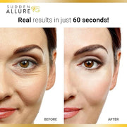 Sudden Allure Instant Under Eye Treatment Serum – Erase Under Eye Bags, Dark Circles, Wrinkles & Lift Sagging Eyes - Insta...