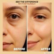 Under Eye Patches with Caffeine, Collagen & Niacinamide (30 Pairs) – Hydrating Eye Mask for Puffy Eyes, Dark Circles, Wrin...
