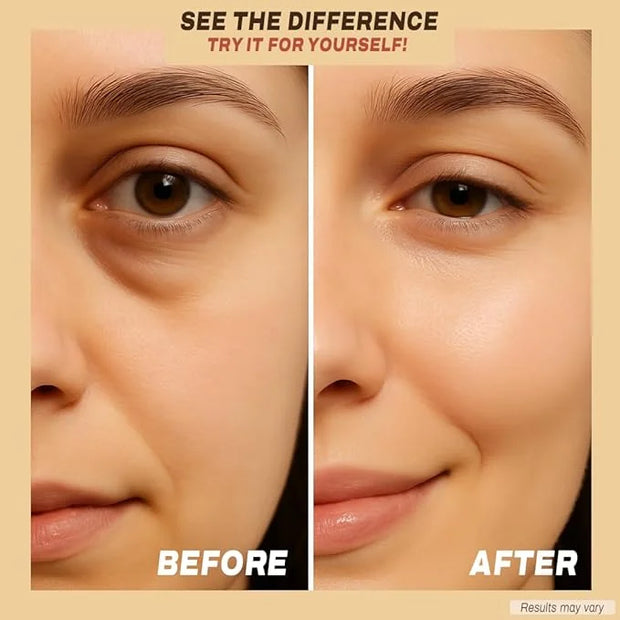 Under Eye Patches with Caffeine, Collagen & Niacinamide (30 Pairs) – Hydrating Eye Mask for Puffy Eyes, Dark Circles, Wrin...