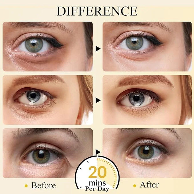Under Eye Patches(24K Gold 15 Pairs), Gel Eye Mask for Reduce Dark Circles, Puffy Eyes,Undereye Bags, Wrinkles,-with Hyalu...