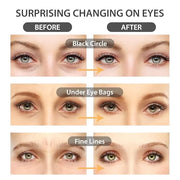 NEWGO Under Eye Mask Patches 20 Pairs Eye Gel Pads, 24K Gold Under Eye Pads Eye Mask Moisturizer Natural Collagen Eye Gels...
