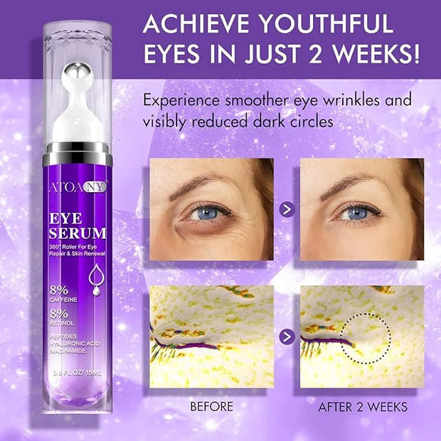 2 Packs Eye Serum for Dark Circles and Puffiness with 8% Caffeine 8% Retinol Hyaluronic Acid Niacinamide, Under Eye Cream ...