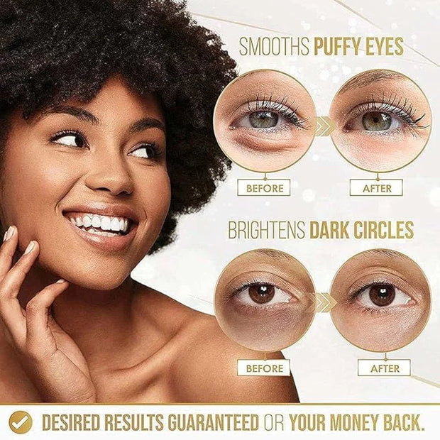 Gold Eye Mask Hydrating Moisturizing Gentle Moisturizing Improve Eye Dryness Eye Mask Patch - Product Image
