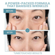 Anti-Aging Eye Gel - Luxurious Hydrating Under Eye Cream For Dark Circles and Puffiness, Bags, Crows Feet, Wrinkles - With...