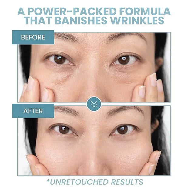 Anti-Aging Eye Gel - Luxurious Hydrating Under Eye Cream For Dark Circles and Puffiness, Bags, Crows Feet, Wrinkles - With...