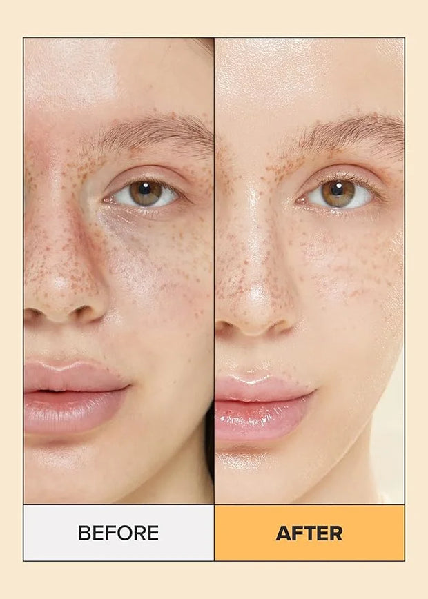 I DEW CARE Real Herb Calendula Sheet Face Mask - Hot As Sheet | Korean Face Masks Skincare, Moisturizing and Calming for D...
