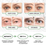 Under Eye Mask for Puffy