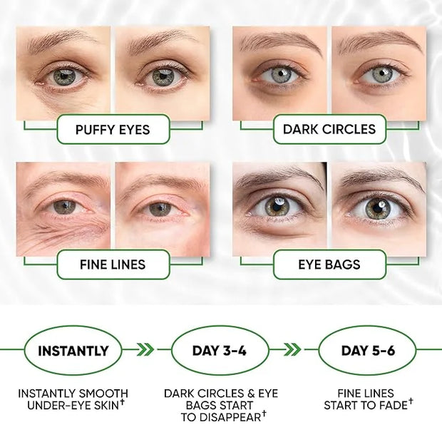 Under Eye Mask for Puffy