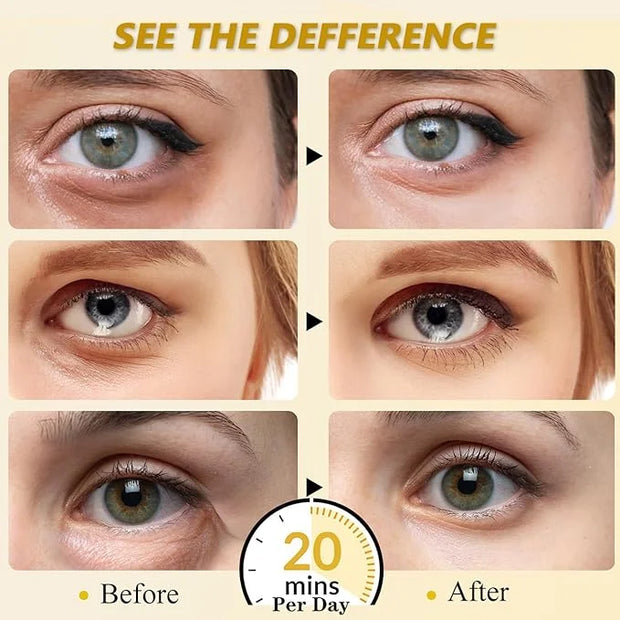 30 Pairs 24K Gold Eye Masks, Collagen Eye Patches for Puffy Eyes and Dark Circles Treatments, Reduce Undereye Bags,Wrinkle...