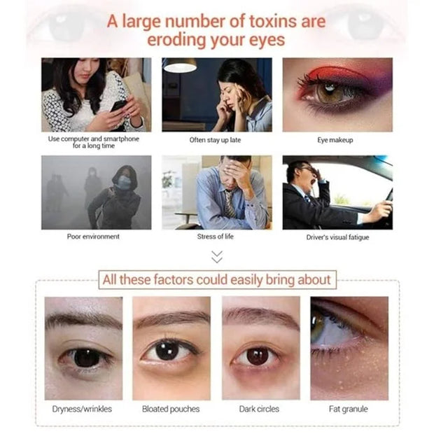 Under Eye Patches - 30 Pairs Collagen Eye Mask Eye Patches for Puffy Eyes and Dark Circles, Gel Under Eye Mask, Black - Pr...