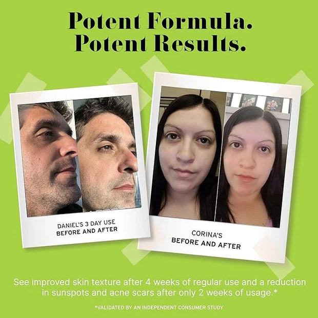 No B.S. (No Bad Stuff) Caffeine Eye Cream anti aging bundle with Two CoQ10 Deluxe Minis. Under Eye Cream for Dark Circles ...