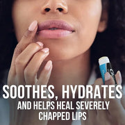 ChapStick Classic Medicated Lip Balm Tubes,