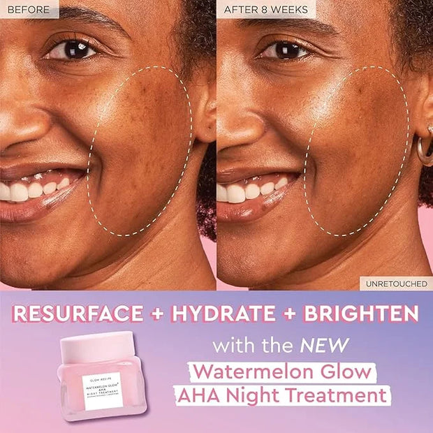 Glow Recipe Watermelon Glow AHA Night Treatment - Overnight Resurfacing Mask with AHA Complex, Hyaluronic Acid, Niacinamid...
