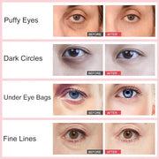 Retinol Eye Stick,Collagen Retinol Eye Cream for Dark Circles and Puffiness, Under Eye Cream Anti Aging, Eye Brightener St...