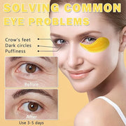 DAMUSI Gold Under Eye Patches for Puffy Eyes and Dark Circles,Moisturise 24k Gold Eye Mask for Dark Circles,Smooth Wrinkle...
