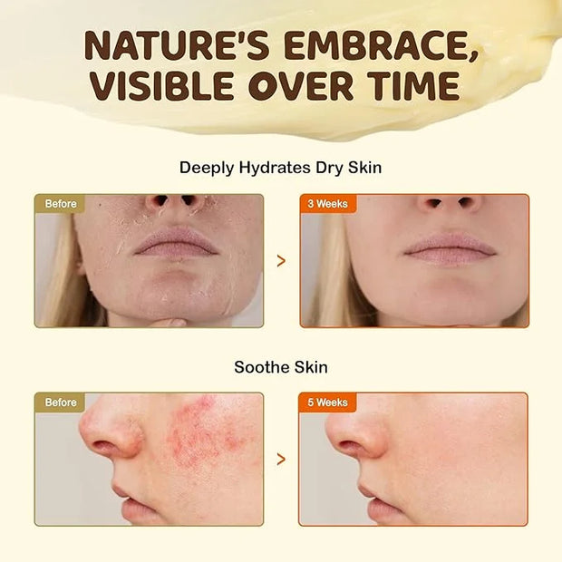 Vigority Beef Tallow and Honey Balm: Organic Grass Fed Whipped Beef Tallow for Skin - Beef Tallow Face Moisturizer Infused...