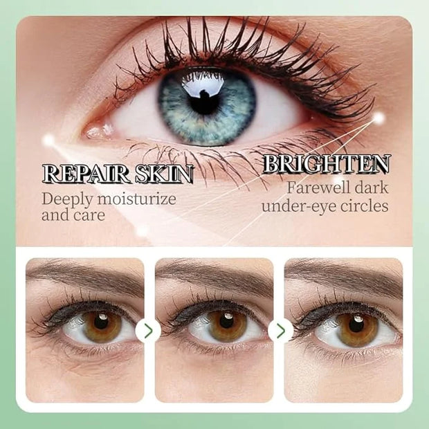 Under Eye Patches, 60PCS Aloe Vera Under Eye Mask for Dark Circles and Puffiness, Under Eye Gel Pads Improve Under Eye Bag...