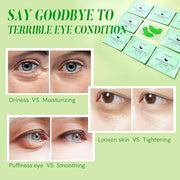 Under Eye Patches with Retinol and Aloe Vera Eye Mask for Dark Circles and Puffiness, Face Mask Skin Care Products 30 Pair...