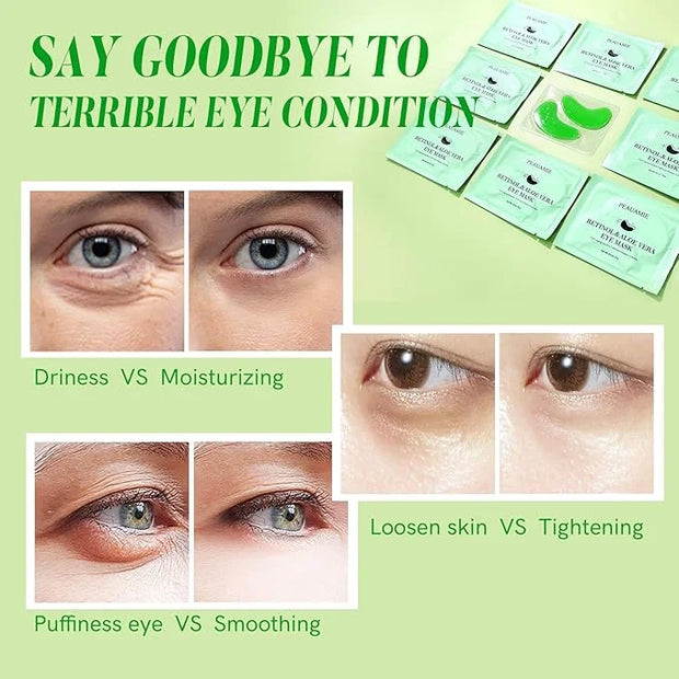 Under Eye Patches with Retinol and Aloe Vera Eye Mask for Dark Circles and Puffiness, Face Mask Skin Care Products 30 Pair...
