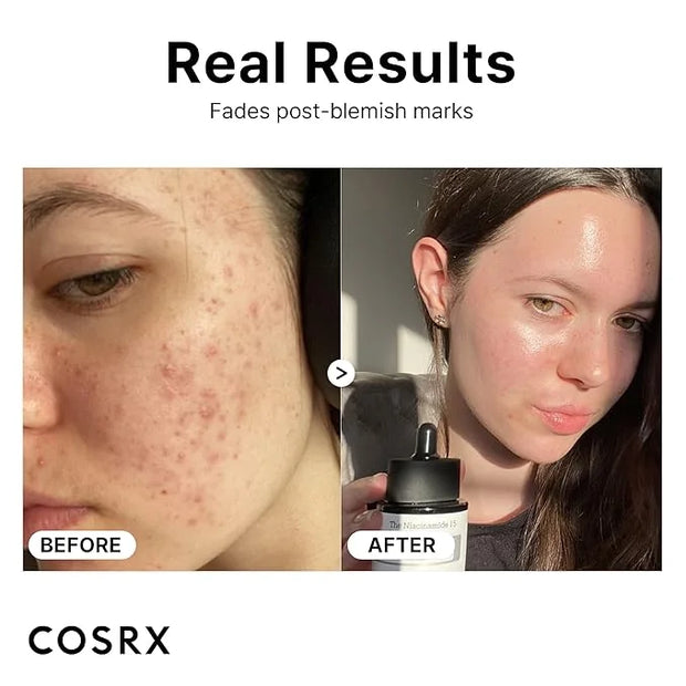 COSRX 15% Niacinamide Face Serum, 0.67 fl oz, Pore Minimizer Serum for Face, Even Skin Tone, Korean Skin Care - Product Image