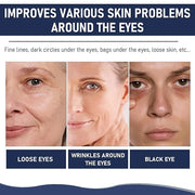 Rapid Reduction Eye Serum, Advanced Formula Instant Eye Serum, Anti Aging Serum Visibly Reduces Under-eye Bags, Nourishing...