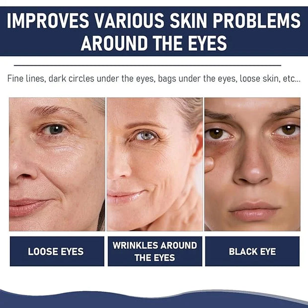 Rapid Reduction Eye Serum, Advanced Formula Instant Eye Serum, Anti Aging Serum Visibly Reduces Under-eye Bags, Nourishing...