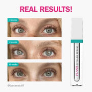 fLASH Eyelash Serum for Long, Curled Natural Lashes - Enhances & Strengthens, Safe & Effective Formula for Contact Wearers...
