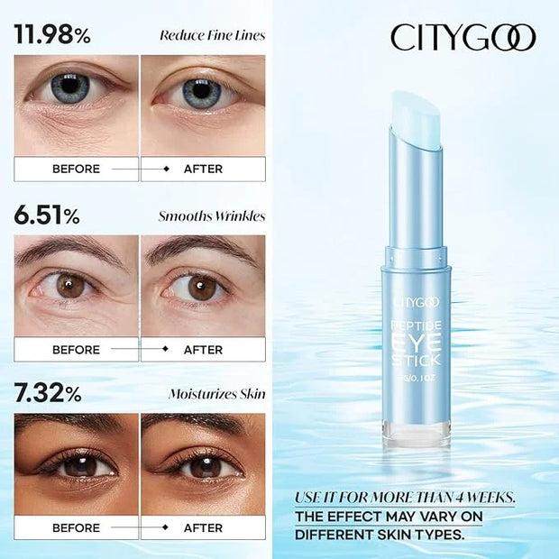 CITYGOO Retinol Eye Stick With Collagen, Hyaluronic Acid For Dark Circle, Under Eye Cream Anti Aging, For Puffiness and Ba...