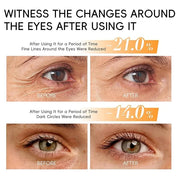 Lumibalm for Under Eye Bags, Turmeric Retinol Eyes Stick, Turmeric Eye Cream Stick, Retinol Eye Cream Sticks, Under Eye Cr...