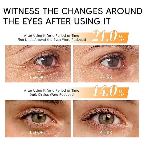 Lumibalm for Under Eye Bags, Turmeric Retinol Eyes Stick, Turmeric Eye Cream Stick, Retinol Eye Cream Sticks, Under Eye Cr...