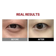 MEDITHERAPY Wrinkle-fit Tangle Eye Cream, Chargable Device Tip + Protein Collagen EyeCream, All-in-One Under Eye Treatment...