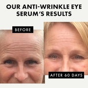 Eclat Skincare Eye Serum with Hyaluronic Acid - Hydrating Formula for Wrinkles, Fine Lines, Crow’s Feet & Eye Bags – Light...