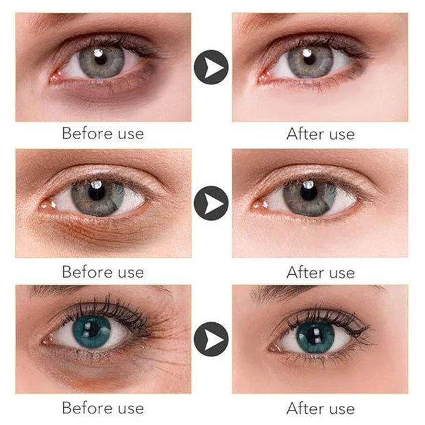 Magic Retinol Eye Cream for Dark Circles Puffiness and Bags Under Eyes, Instant Results Firm Eye Tightener Reduce Fine Lin...