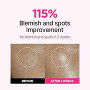 ISOI Blemish Care Up Serum Triple Set, Korean Skin Care for Glass Skin Radiance, Includes 2 Full Size & 1 Refill Serums, E...