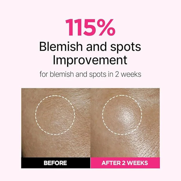 ISOI Blemish Care Up Serum Triple Set, Korean Skin Care for Glass Skin Radiance, Includes 2 Full Size & 1 Refill Serums, E...