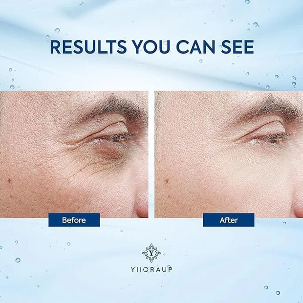 Caffeine Eye Cream for Men: Under Eye Roller for Bags and Puffy Eyes Treatment - Men's Cooling Stick and Depuffer for Dark...