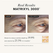 Asterwood Triple Repair Matrixyl 3000 + Argireline + Hyaluronic Acid + Vitamin C Serum for Face - Anti-Aging, Collagen Boo...