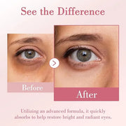 Eye Cream, Caffeine Eye Cream for Puffiness, Wrinkles, Fine Lines, Dark Circles Undereye Treatment for Women & Men, Daily ...