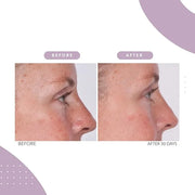 Serious Skincare - Reverse Lift Eye Cream Moisturizer with Peptides - Skin Firming Wrinkle Formula - Temporarily Lift & Fi...